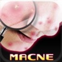 Macne