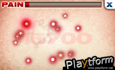 Zits & Giggles (iPhone/iPod)