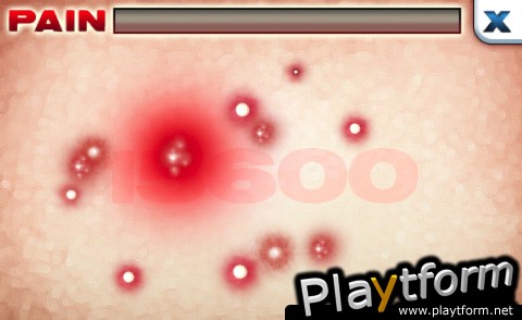 Zits & Giggles (iPhone/iPod)