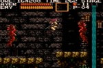 Castlevania Chronicles (PlayStation)