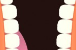 Dentist game (iPhone/iPod)