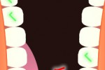 Dentist game (iPhone/iPod)